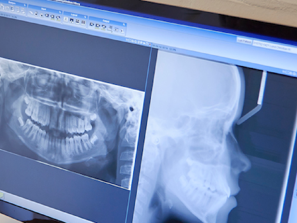 CBCT-scanningsbiillede